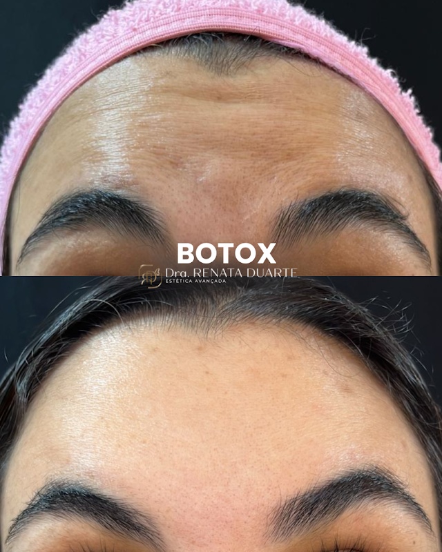 Clínica de Estética em Praia da Costa – Botox, Preenchimento Labial e Tratamento Capilar | Dra Renata Duarte - Clínica de Estética em Praia da Costa, Vila Velha/ES - Foto 4
