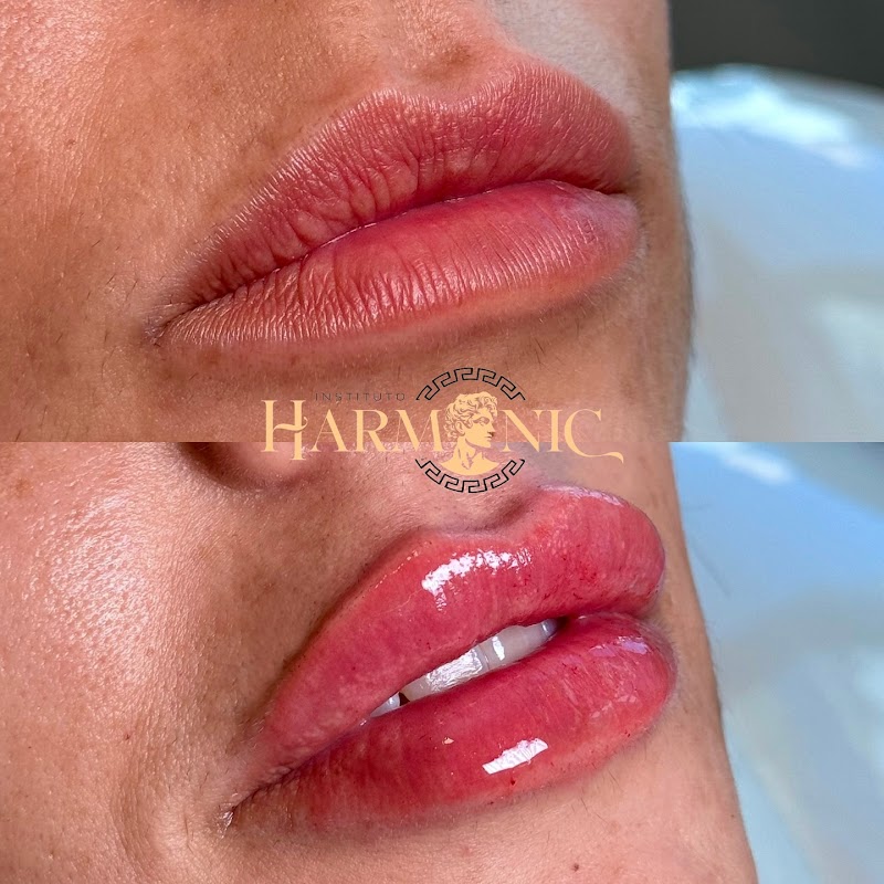 Clínica de Estética em Vila Velha | Instituto Harmonic | Harmonização Facial - Clínica de Estética em Praia da Costa, Vila Velha/ES - Foto 2