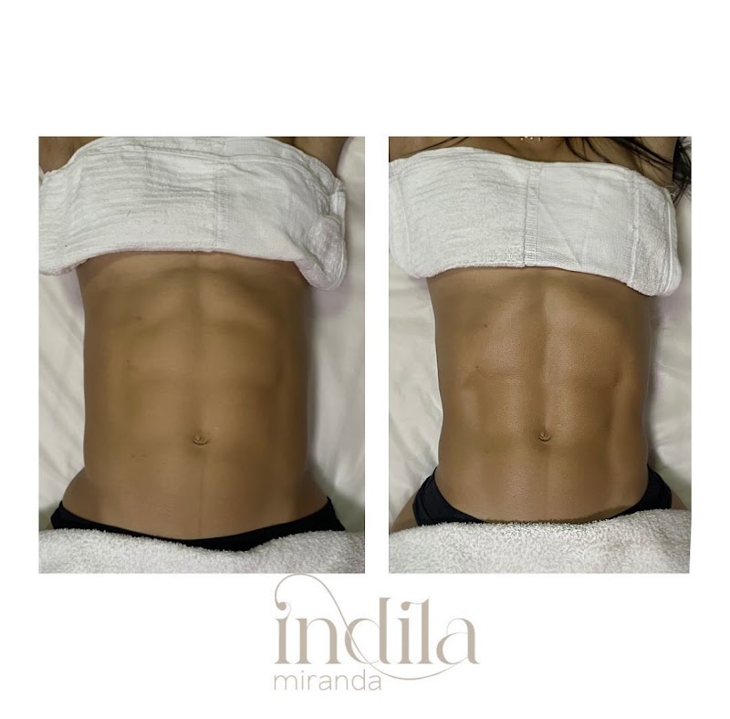 Indila Miranda Esteticista - Clínica de Estética em Praia da Costa, Vila Velha/ES - Foto 4