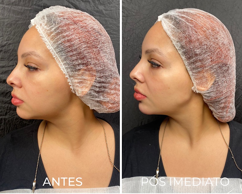 Royal Face Clínica de Estética - Vila Velha - Clínica de Estética em Praia da Costa, Vila Velha/ES - Foto 3