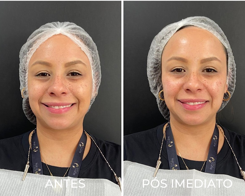 Royal Face Clínica de Estética - Vila Velha - Clínica de Estética em Praia da Costa, Vila Velha/ES - Foto 5