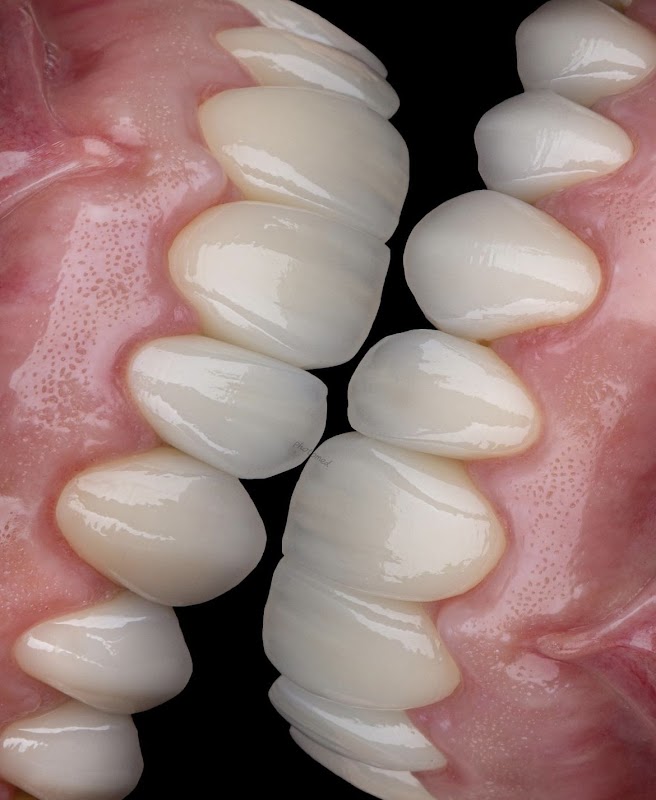 Sorrivix Clínica Odontológica Implantes e Facetas - Clínica Odontológica em Praia da Costa, Vila Velha/ES - Foto 3