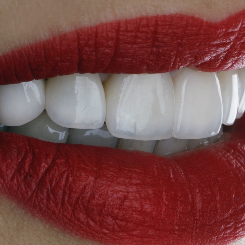 Sorrivix Clínica Odontológica Implantes e Facetas - Clínica Odontológica em Praia da Costa, Vila Velha/ES - Foto 5