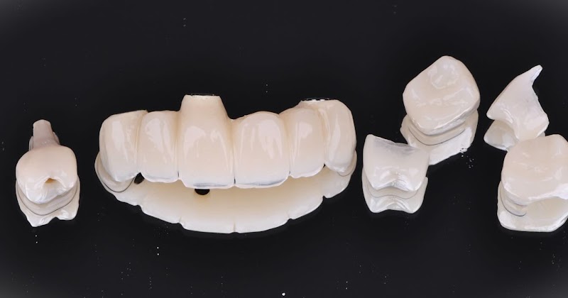 Vitalitty Center – Odontologia de Resultados - Clínica Odontológica em Praia da Costa, Vila Velha/ES - Foto 3